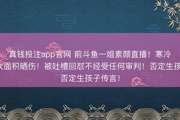 真钱投注app官网 前斗鱼一姐素颜直播！寒冷穿搭被大面积晒伤！被吐槽回怼不经受任何审判！否定生孩子传言！